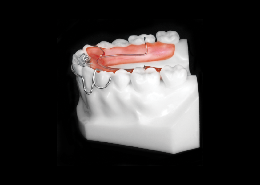 Active Retainer view 3